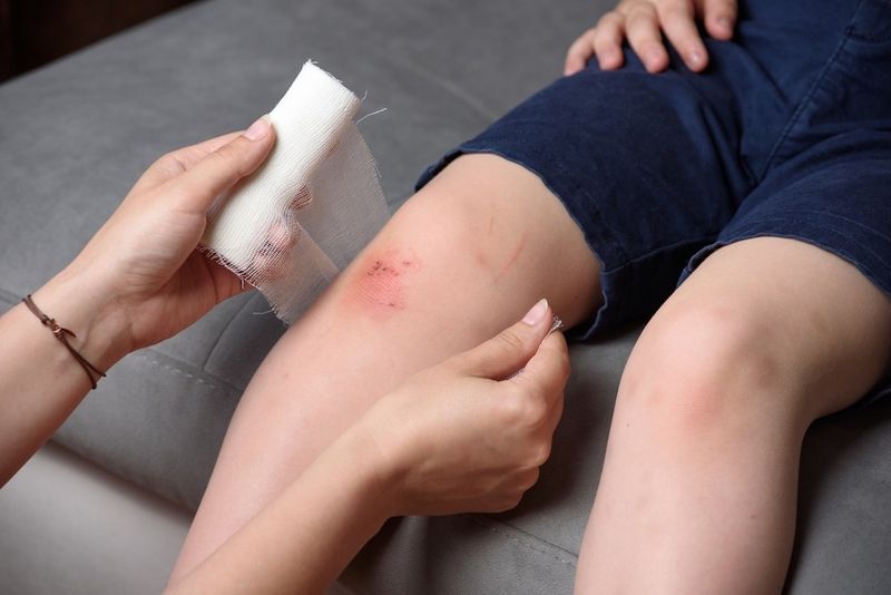 Enhances Wound Healing In Diabetic Ulcers