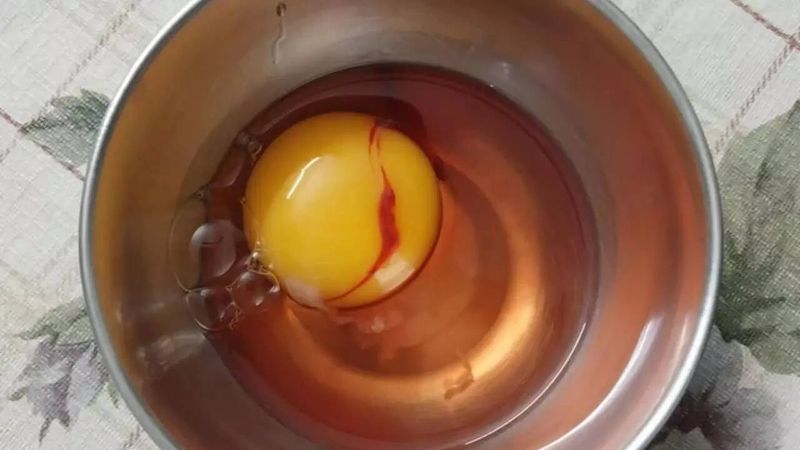 Discoloured Egg White Or Yolk