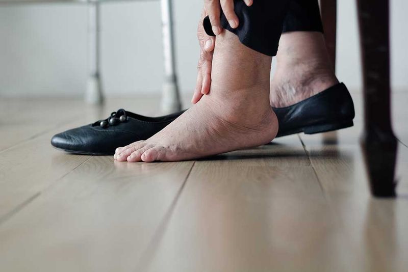 Swelling In Hands, Feet, Or Lips