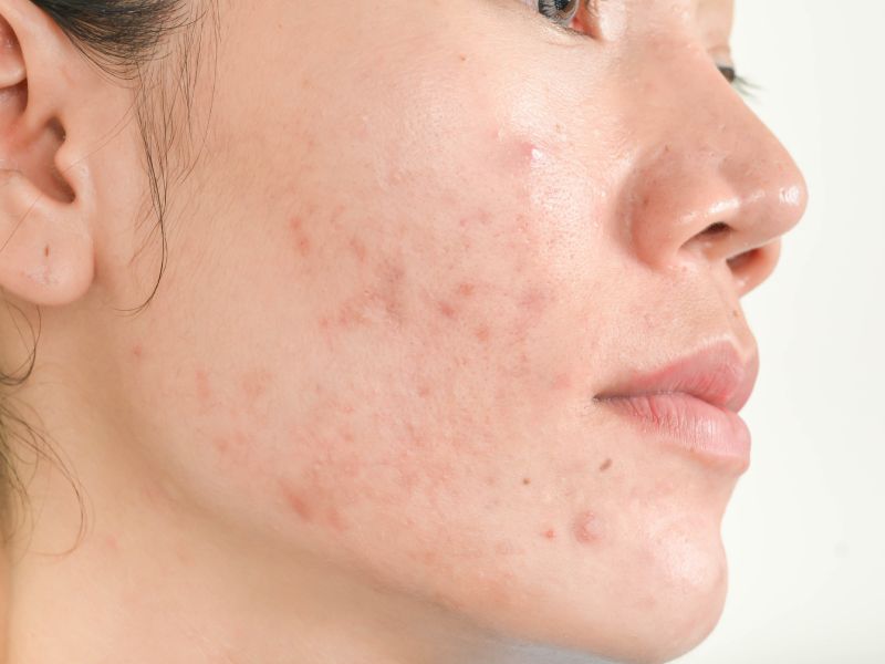 Possible Changes In Skin Health